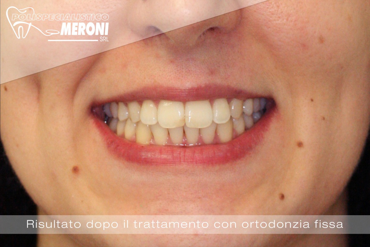 Polispecialistico Meroni, Il tuo dentista a Cantù (Como), impianti  dentali, igiene e prevenzione dentale
