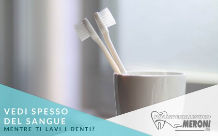Le gengive sanguinano mentre lavi i denti? I nostri dentisti ti spiegano perché e come rimediare
