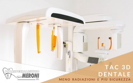 Studio dentistico di Cantù Tac dentale 3D Polispecialistico Meroni